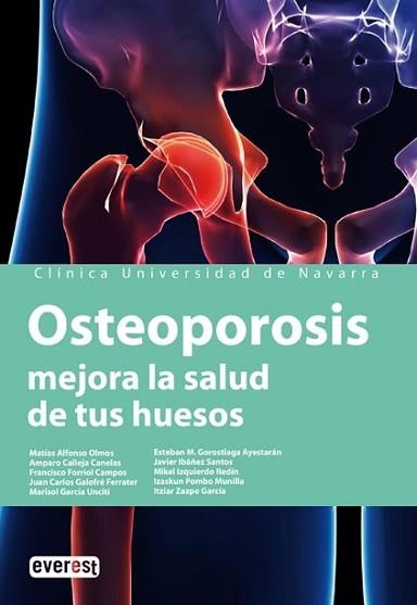 OSTEOPOROSIS, MEJORA LA SALUD DE TUS HUESOS | 9788424184315 | VV.AA. | Llibreria Aqualata | Comprar llibres en català i castellà online | Comprar llibres Igualada